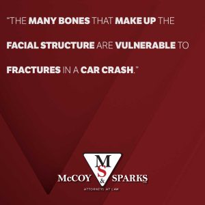 facial fractures 